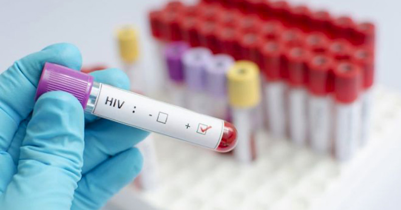 Potent antibodies that neutralize HIV have been discovered